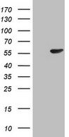 PELI1 / Pellino 1 Antibody - HEK293T cells were transfected with the pCMV6-ENTRY control (Left lane) or pCMV6-ENTRY PELI1 (Right lane) cDNA for 48 hrs and lysed. Equivalent amounts of cell lysates (5 ug per lane) were separated by SDS-PAGE and immunoblotted with anti-PELI1.