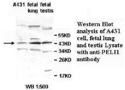 PELI1 / Pellino 1 Antibody