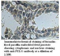 PELI3 / Pellino 3 Antibody