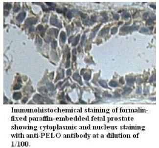 PELI3 / Pellino 3 Antibody