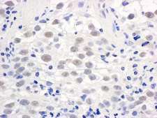 PELP1 Antibody - Detection of Human PELP1/MNAR by Immunohistochemistry. Sample: FFPE section of human testicular seminoma. Antibody: Affinity purified rabbit anti-PELP1/MNAR used at a dilution of 1:1000 (1 ug/ml). Detection: DAB.