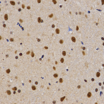 PELP1 Antibody - Immunohistochemistry of paraffin-embedded rat brain tissue.