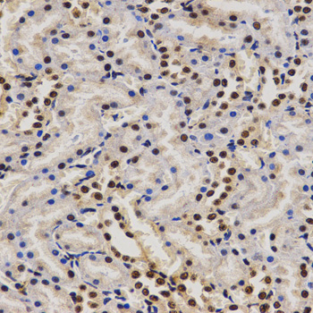 PELP1 Antibody - Immunohistochemistry of paraffin-embedded rat kidney tissue.