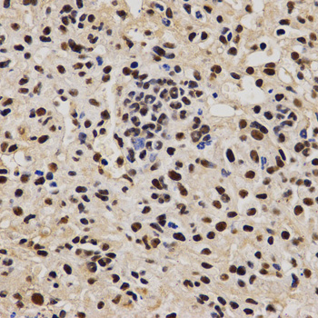 PELP1 Antibody - Immunohistochemistry of paraffin-embedded Mouse liver fibrosis tissue.