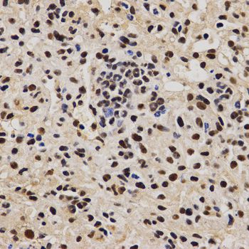 PELP1 Antibody - Immunohistochemistry of paraffin-embedded mouse liver fibrosis using PELP1 antibody at dilution of 1:200 (40x lens).