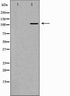 PELP1 Antibody - Western blot analysis of extracts of HeLa cells using PELP1 antibody. The lane on the left is treated with the antigen-specific peptide.