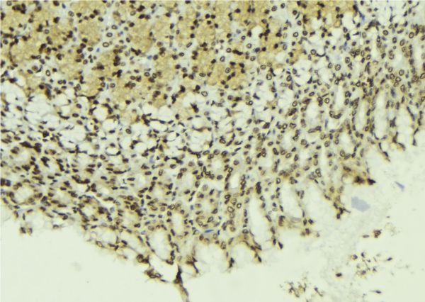 PELP1 Antibody - 1:100 staining human gastric tissue by IHC-P. The sample was formaldehyde fixed and a heat mediated antigen retrieval step in citrate buffer was performed. The sample was then blocked and incubated with the antibody for 1.5 hours at 22°C. An HRP conjugated goat anti-rabbit antibody was used as the secondary.