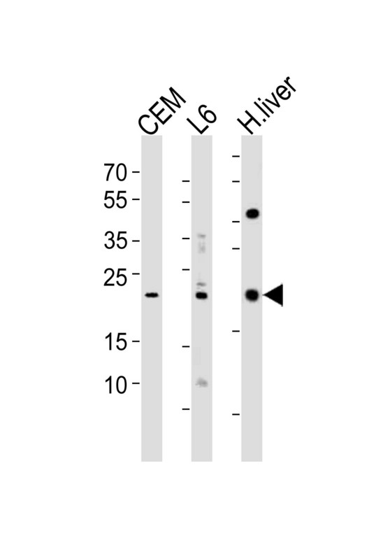 PEMT Antibody - Western blot of lysates from CEM, rat L6 cell line and human liver tissue lysate(from left to right), using PEMT Antibody. Antibody was diluted at 1:1000 at each lane. A goat anti-rabbit IgG H&L (HRP) at 1:10000 dilution was used as the secondary antibody. Lysates at 35ug per lane.