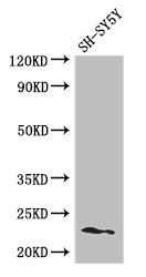 PEMT Antibody - Positive WB detected in:SH-SY5Y whole cell lysate;All lanes: PEMT antibody at 2.8ug/ml;Secondary;Goat polyclonal to rabbit IgG at 1/50000 dilution;Predicted band size: 23,26,25 kDa;Observed band size: 23 kDa;