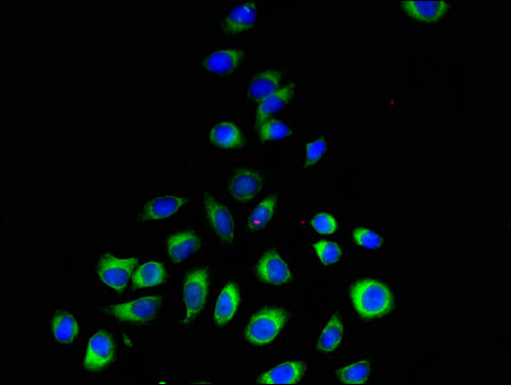 PEMT Antibody - Immunofluorescent analysis of A549 cells using PEMT Antibody at a dilution of 1:100 and Alexa Fluor 488-congugated AffiniPure Goat Anti-Rabbit IgG(H+L)