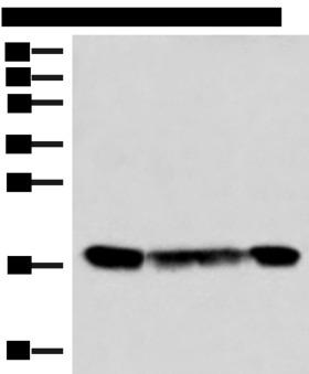 PEMT Antibody - Western blot analysis of 293T and 231 cell lysates  using PEMT Polyclonal Antibody at dilution of 1:800