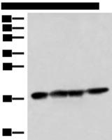 PEMT Antibody - Western blot analysis of 293T HepG2 and Mouse liver tissue lysates  using PEMT Polyclonal Antibody at dilution of 1:800