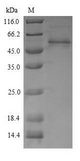 CKM / Creatine Kinase MM Protein - (Tris-Glycine gel) Discontinuous SDS-PAGE (reduced) with 5% enrichment gel and 15% separation gel.