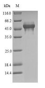 Tropomyosin Protein - (Tris-Glycine gel) Discontinuous SDS-PAGE (reduced) with 5% enrichment gel and 15% separation gel.