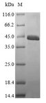 Sarcoplasmic calcium-binding protein, alpha-B and -A chains Protein - (Tris-Glycine gel) Discontinuous SDS-PAGE (reduced) with 5% enrichment gel and 15% separation gel.