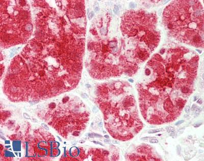 PEPD / PROLIDASE Antibody - Human Kidney: Formalin-Fixed, Paraffin-Embedded (FFPE).  This image was taken for the unconjugated form of this product. Other forms have not been tested.