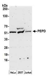 PEPD / PROLIDASE Antibody - Detection of human PEPD by western blot. Samples: Whole cell lysate (50 µg) from HeLa, HEK293T, and Jurkat cells prepared using NETN lysis buffer. Antibody: Affinity purified rabbit anti-PEPD antibody used for WB at 0.1 µg/ml. Detection: Chemiluminescence with an exposure time of 3 minutes.