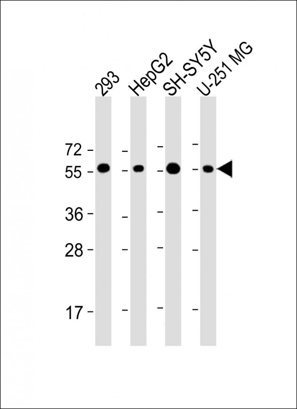 PEPD / PROLIDASE Antibody - All lanes: Anti-PEPD Antibody (C-Term) at 1:2000 dilution Lane 1: 293 whole cell lysate Lane 2: HepG2 whole cell lysate Lane 3: SH-SY5Y whole cell lysate Lane 4: U-251 MG whole cell lysate Lysates/proteins at 20 µg per lane. Secondary Goat Anti-Rabbit IgG, (H+L), Peroxidase conjugated at 1/10000 dilution. Predicted band size: 55 kDa Blocking/Dilution buffer: 5% NFDM/TBST.