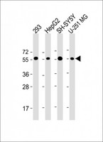 PEPD / PROLIDASE Antibody - All lanes: Anti-PEPD Antibody (C-Term) at 1:2000 dilution Lane 1: 293 whole cell lysate Lane 2: HepG2 whole cell lysate Lane 3: SH-SY5Y whole cell lysate Lane 4: U-251 MG whole cell lysate Lysates/proteins at 20 µg per lane. Secondary Goat Anti-Rabbit IgG, (H+L), Peroxidase conjugated at 1/10000 dilution. Predicted band size: 55 kDa Blocking/Dilution buffer: 5% NFDM/TBST.