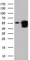 PEPD / PROLIDASE Antibody - HEK293T cells were transfected with the pCMV6-ENTRY control (Left lane) or pCMV6-ENTRY PEPD (Right lane) cDNA for 48 hrs and lysed. Equivalent amounts of cell lysates (5 ug per lane) were separated by SDS-PAGE and immunoblotted with anti-PEPD.