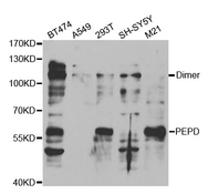 PEPD / PROLIDASE Antibody - Western blot analysis of extracts of various cell lines.