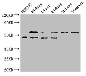 PEPD / PROLIDASE Antibody - Positive WB detected in:HEK293 whole cell lysate,Rat kidney tissue,Mouse liver tissue,Mouse kidney tissue,Mouse spleen tissue,Mouse stomach tissue;All lanes:PEPD antibody at 1.5?g/ml;Secondary;Goat polyclonal to rabbit IgG at 1/50000 dilution;Predicted band size: 55,50,48 KDa;Observed band size: 55,48 KDa;
