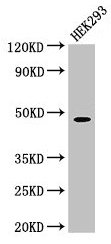 PEPD / PROLIDASE Antibody - Western Blot Positive WB detected in: HEK293 whole cell lysate All lanes: PEPD antibody at 1.5µg/ml Secondary Goat polyclonal to rabbit IgG at 1/50000 dilution Predicted band size: 55, 50, 48 kDa Observed band size: 48 kDa