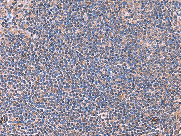PEPD / PROLIDASE Antibody - Immunohistochemistry of paraffin-embedded Human tonsil tissue  using PEPD Polyclonal Antibody at dilution of 1:70(×200)