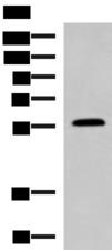 PEPD / PROLIDASE Antibody - Western blot analysis of Mouse small intestines tissue lysate  using PEPD Polyclonal Antibody at dilution of 1:1000