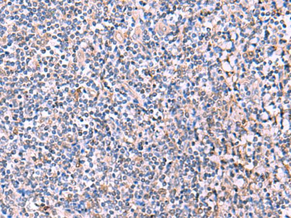 PEPD / PROLIDASE Antibody - Immunohistochemistry of paraffin-embedded Human tonsil tissue  using PEPD Polyclonal Antibody at dilution of 1:85(×200)