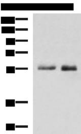 PEPD / PROLIDASE Antibody - Western blot analysis of HepG2 cell Mouse small intestines tissue lysates  using PEPD Polyclonal Antibody at dilution of 1:1000