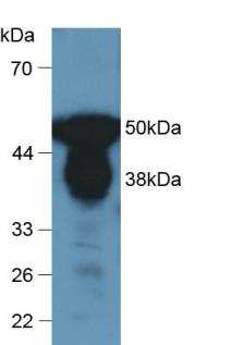 Pepsin Antibody - Western Blot; Samples: Human Urine.
