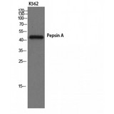 Pepsin Antibody - Western blot of Pepsin A antibody