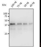Pepsin Antibody - Anti-Pepsin antibody at 1:500 dilution. 40-100 ng of pepsin isolated from porcine gastric mucosa. Rabbit polyclonal to goat IgG (HRP) at 1:10000 dilution.