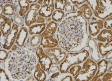 Pepsinogen A Antibody - 1:100 staining mouse kidney tissue by IHC-P. The sample was formaldehyde fixed and a heat mediated antigen retrieval step in citrate buffer was performed. The sample was then blocked and incubated with the antibody for 1.5 hours at 22°C. An HRP conjugated goat anti-rabbit antibody was used as the secondary.