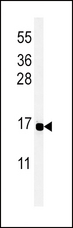 Peptide YY / PYY Antibody - Western blot of PYY Antibody in MCF-7 cell line lysates (35 ug/lane). PYY (arrow) was detected using the purified antibody.