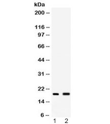 Peptide YY / PYY Antibody - Western blot testing of 1) mouse spleen and 2) mouse liver lysate with PYY antibody at 0.5ug/ml. Expected molecular weight: 11/4 kDa (preproprotein/mature).