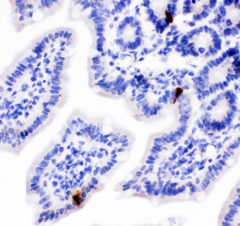 Peptide YY / PYY Antibody - IHC testing of FFPE mouse intestine with PYY antibody. HIER: boil tissue sections in pH6, 10mM citrate buffer, for 10-20 min followed by cooling at RT for 20 min.