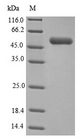 GLUD1/Glutamate Dehydrogenase Protein - (Tris-Glycine gel) Discontinuous SDS-PAGE (reduced) with 5% enrichment gel and 15% separation gel.