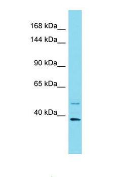 PER1 Antibody - Western blot of Human Breast Tumor. PER1 antibody dilution 1.0 ug/ml.  This image was taken for the unconjugated form of this product. Other forms have not been tested.