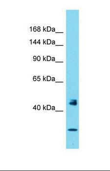 PER1 Antibody - Western blot of Human Thyroid Tumor. PER1 antibody dilution 1.0 ug/ml.  This image was taken for the unconjugated form of this product. Other forms have not been tested.