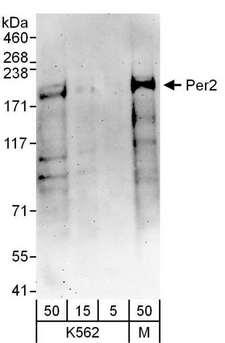 PER2 Antibody - Detection of Human Per2 by Western Blot. Samples: Whole cell lysate from K562 (5, 15 and 50 ug) and MCF7 (M; 50 ug) cells. Antibodies: Affinity purified rabbit anti-Per2 antibody used for WB at 0.4 ug/ml. Detection: Chemiluminescence with an exposure time of 3 minutes.