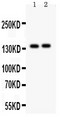 PER2 Antibody - PER2 antibody Western blot. All lanes: Anti PER2 at 0.5 ug/ml. Lane 1: A549 Whole Cell Lysate at 40 ug. Lane 2: PANC Whole Cell Lysate at 40 ug. Predicted band size: 136 kD. Observed band size: 136 kD.