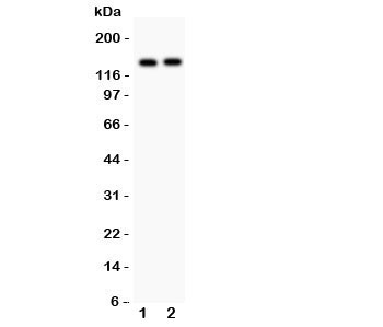 PER2 Antibody - Western blot testing of PER2 antibody and Lane 1: A549; 2: PANC lysate