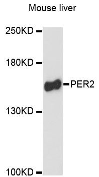 PER2 Antibody - Western blot analysis of extracts of mouse liver, using PER2 antibody at 1:3000 dilution. The secondary antibody used was an HRP Goat Anti-Rabbit IgG (H+L) at 1:10000 dilution. Lysates were loaded 25ug per lane and 3% nonfat dry milk in TBST was used for blocking. An ECL Kit was used for detection and the exposure time was 90s.