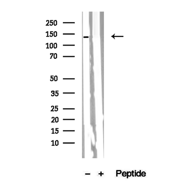 PER2 Antibody - Western blot analysis of extracts of K562 cells using PER2 antibody.