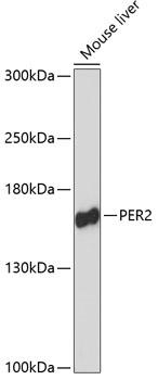 PER2 Antibody - Western blot analysis of extracts of mouse liver using PER2 Polyclonal Antibody at dilution of 1:3000.
