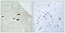 PER2 Antibody - Immunohistochemistry analysis of paraffin-embedded human brain, using Period Circadian Protein 2 (Phospho-Ser662) Antibody. The picture on the right is blocked with the phospho peptide.