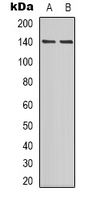 PER2 Antibody - Western blot analysis of PER2 (pS662) expression in NIH3T3 (A); mouse lung (B) whole cell lysates.
