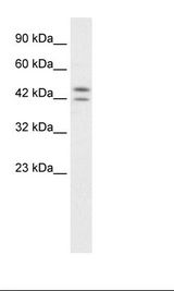PER3 Antibody - Jurkat Cell Lysate.  This image was taken for the unconjugated form of this product. Other forms have not been tested.